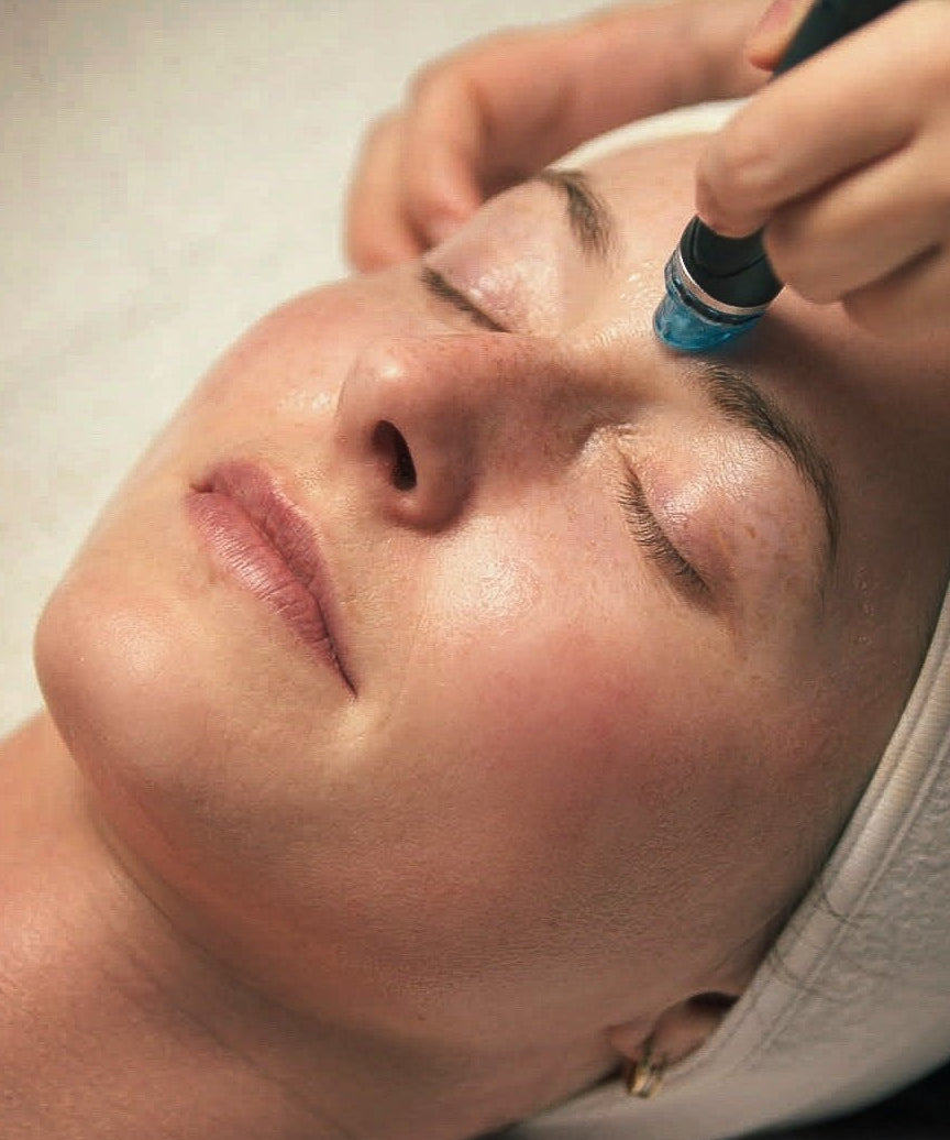 Hydrafacial - Beauties Lab - Beauties Lab