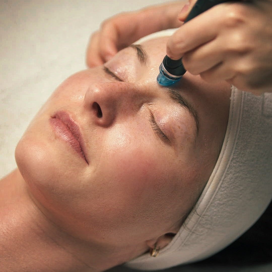 Hydrafacial - Beauties Lab - Beauties Lab