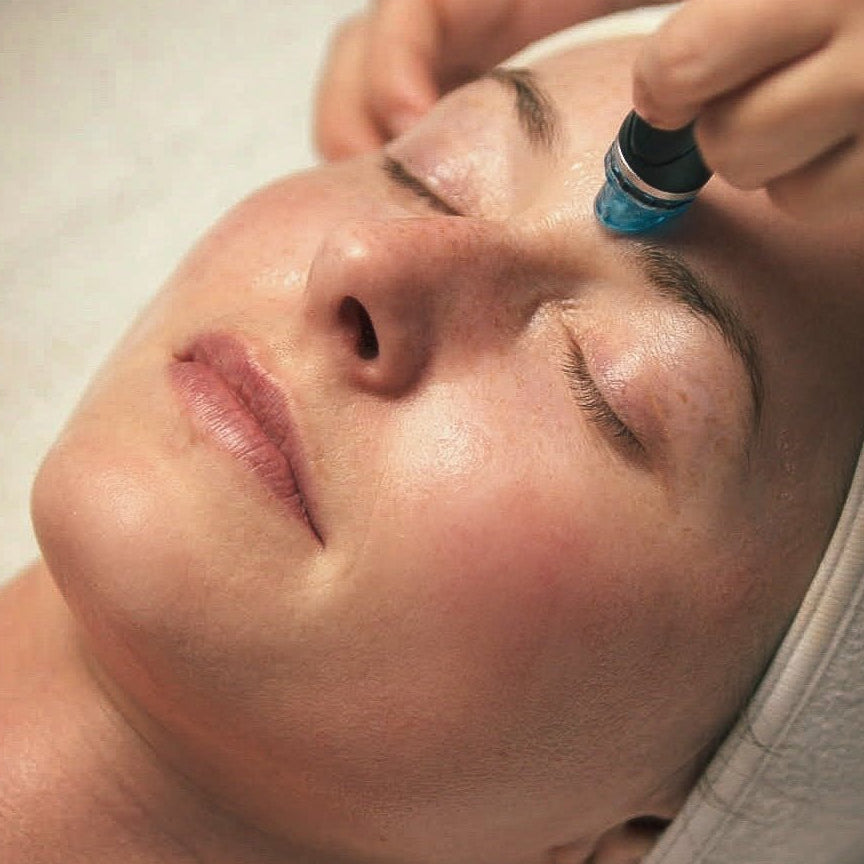 Hydrafacial - Beauties Lab - Beauties Lab