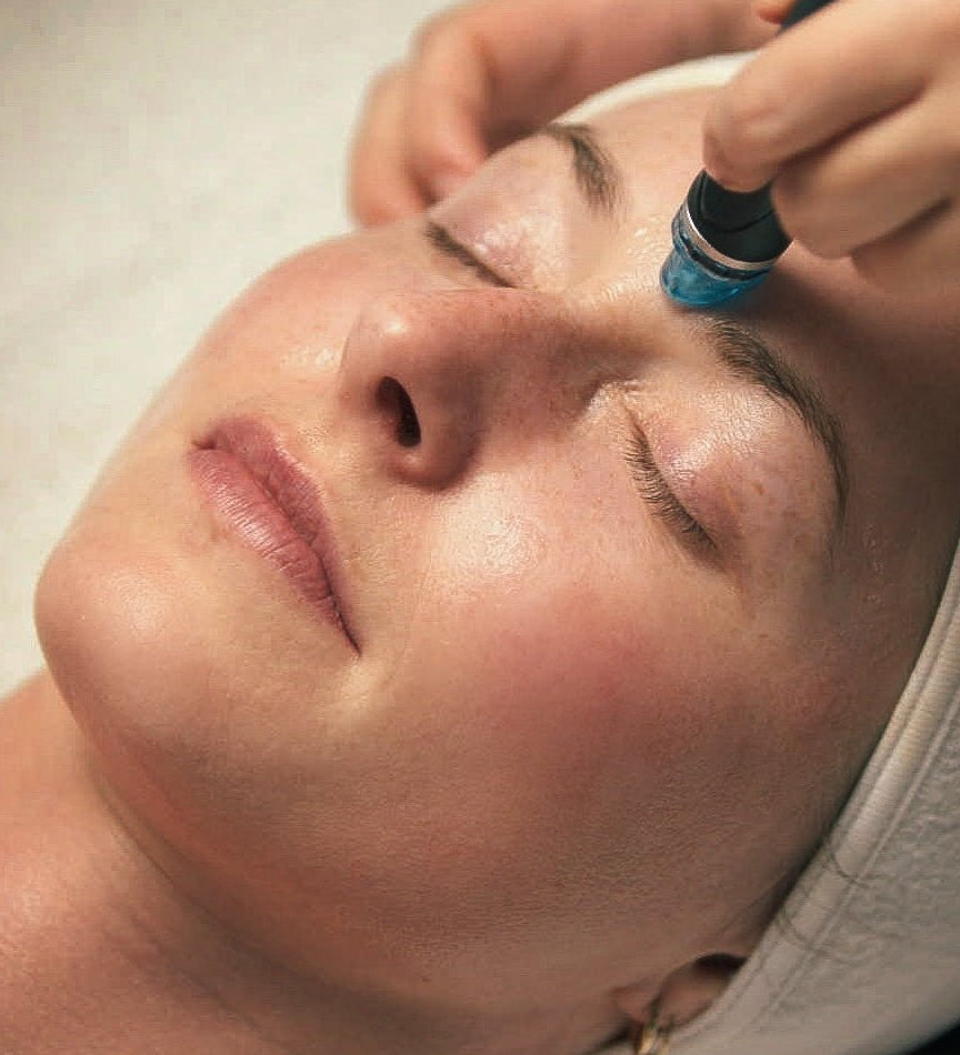 Hydrafacial - Beauties Lab - Beauties Lab