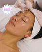 Microneedling Treatment - Beauties Lab - enimage