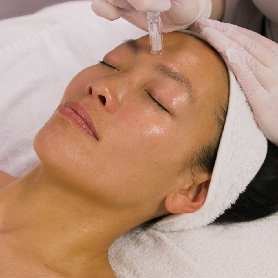 Microneedling Treatment - Beauties Lab - Beauties Lab
