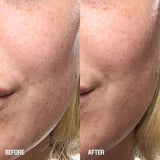 Skin Renewal Serum - Grown Alchemist - Beauties Lab