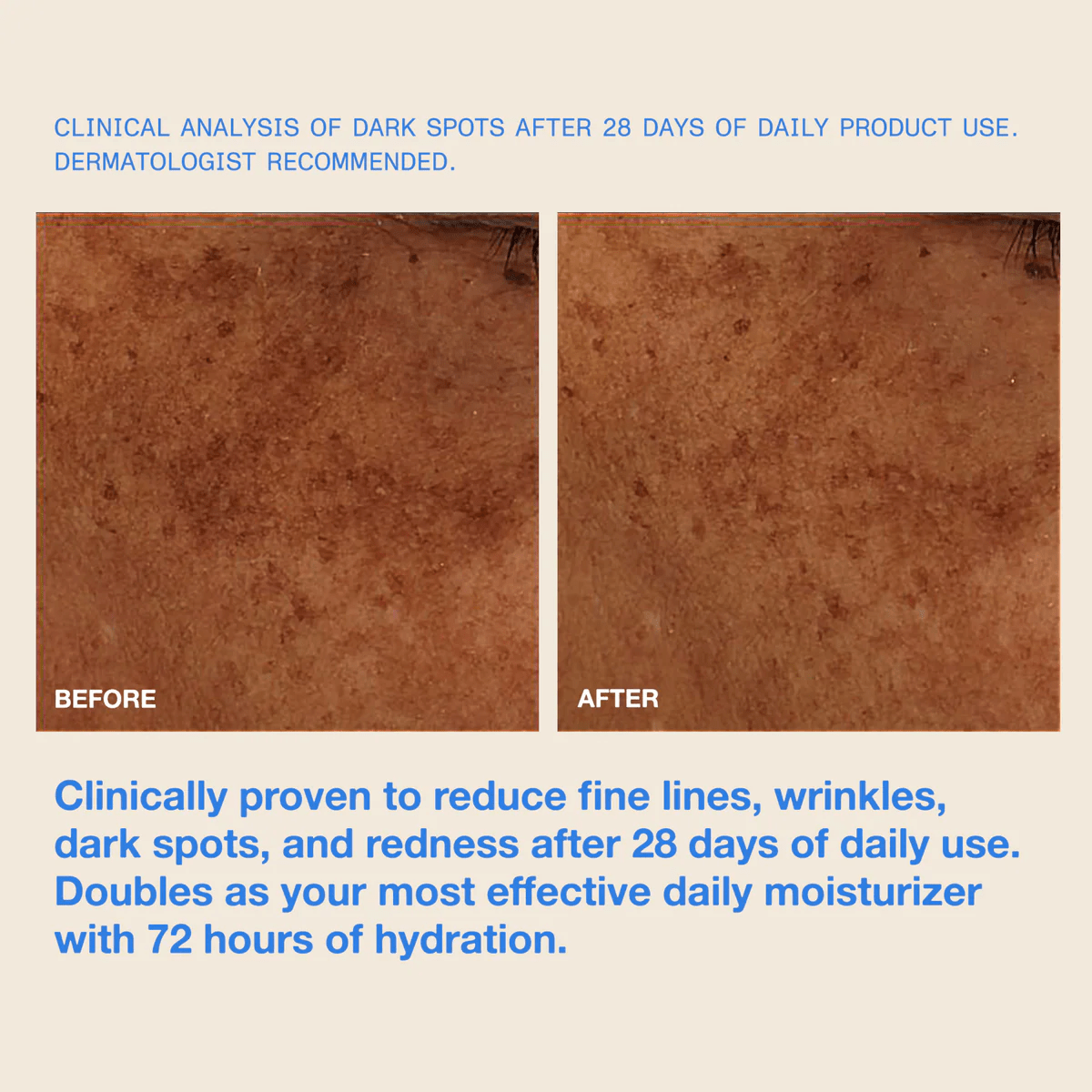 The Mug Guard Invisible Facial Gel - Dune Suncare - Beauties Lab