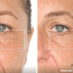 TheraFace LED Mask Glo - Therabody - Beauties Lab